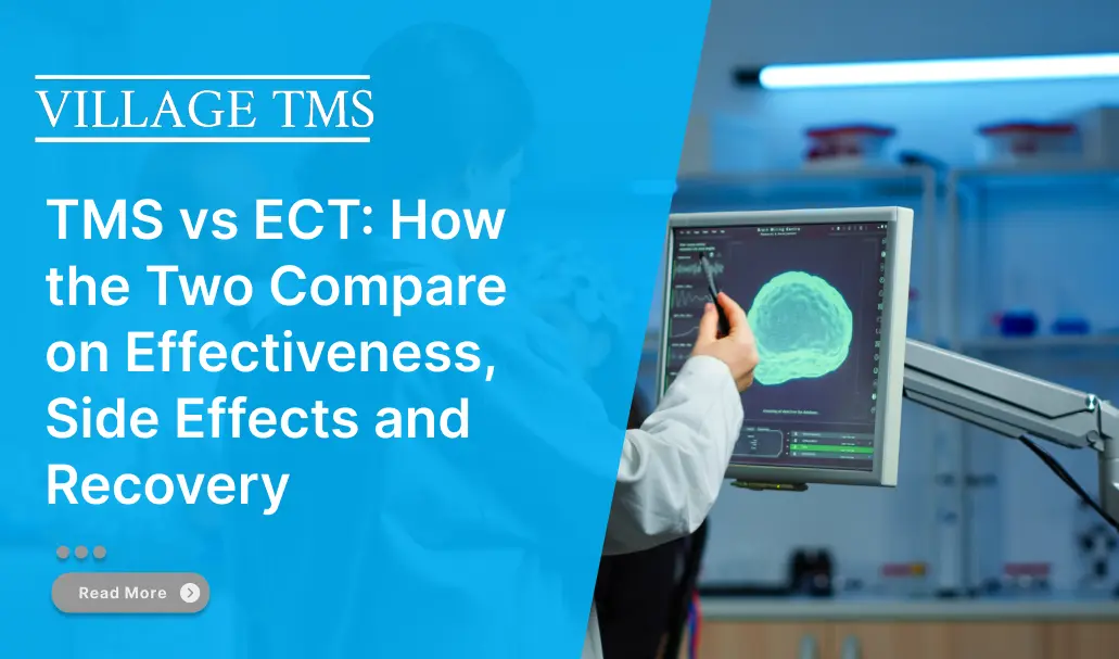 TMS vs ect